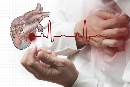 Диагностика инфаркта миокарда на дому